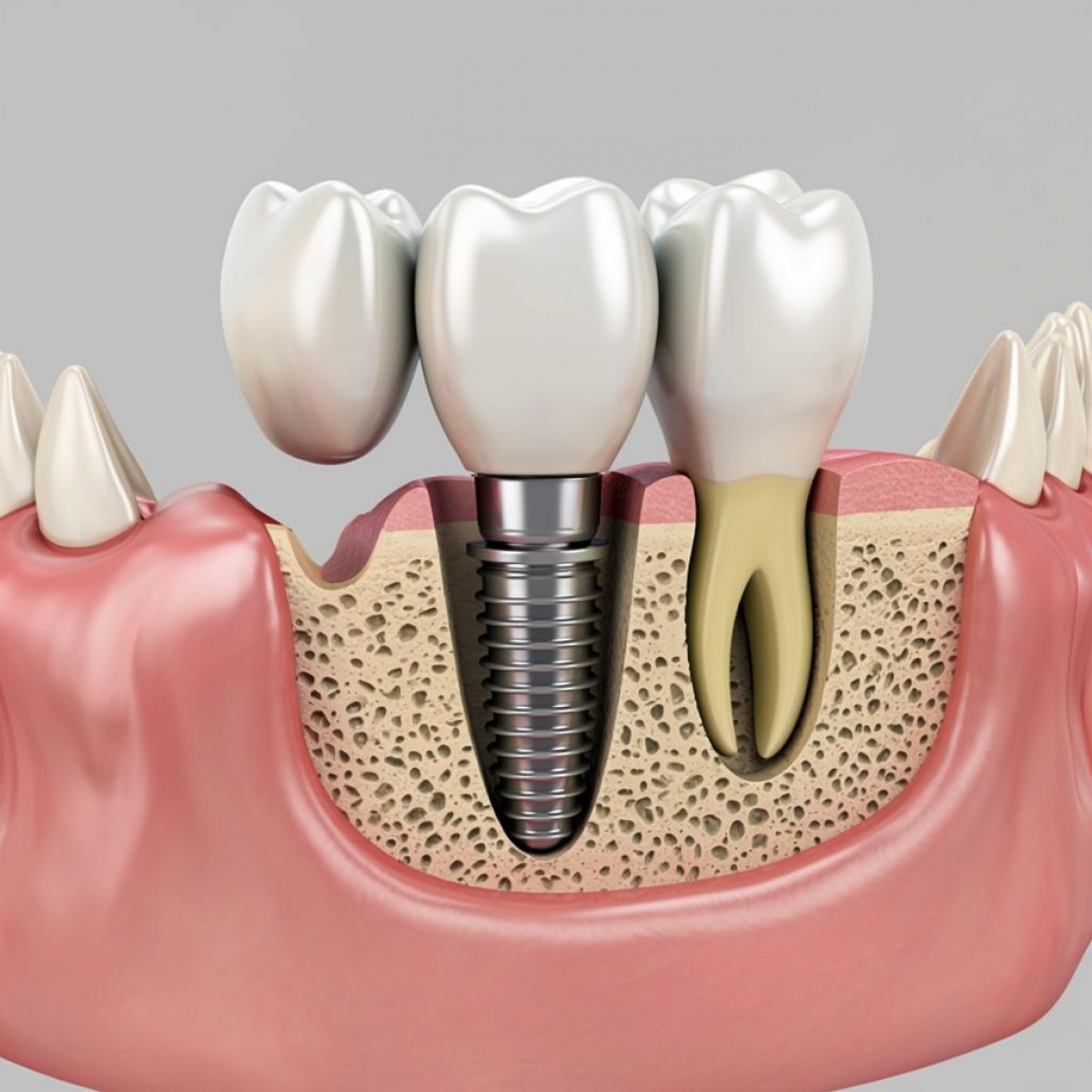 ��������� ���������� �������� �����: �������� ������ ������ ������