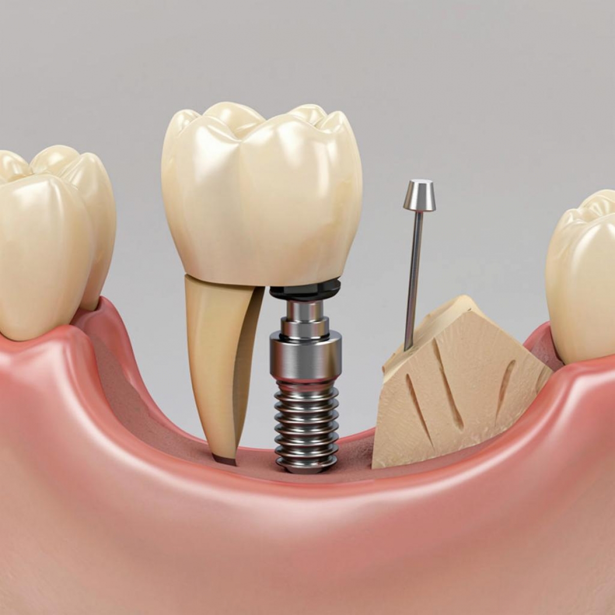 ��� ����� ��������� ������� ����? �������� ��� ������ ����������� �����