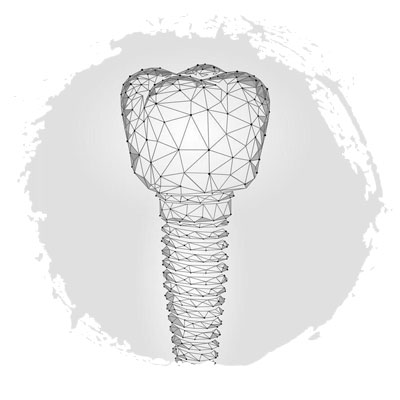 Классическая имплантация